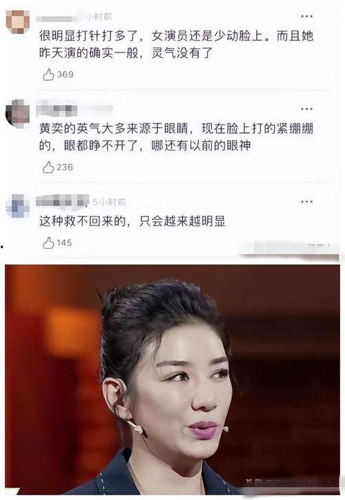 歪嘴女明星网红,独特魅力征服网友，揭秘她的网红之路